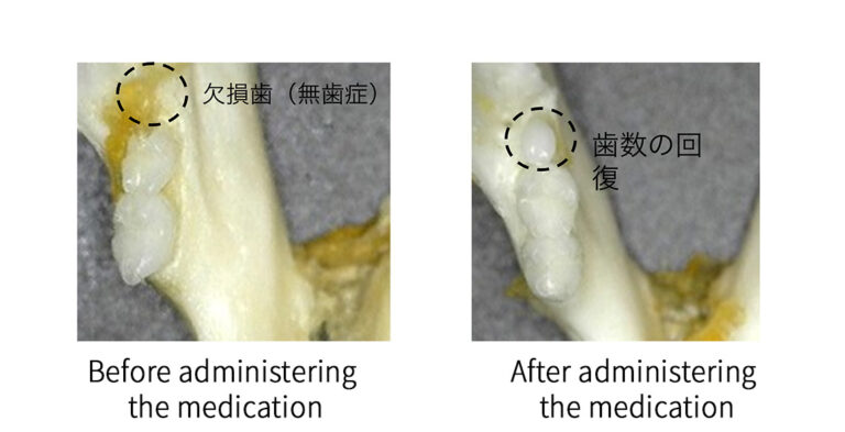 human teeth restoration